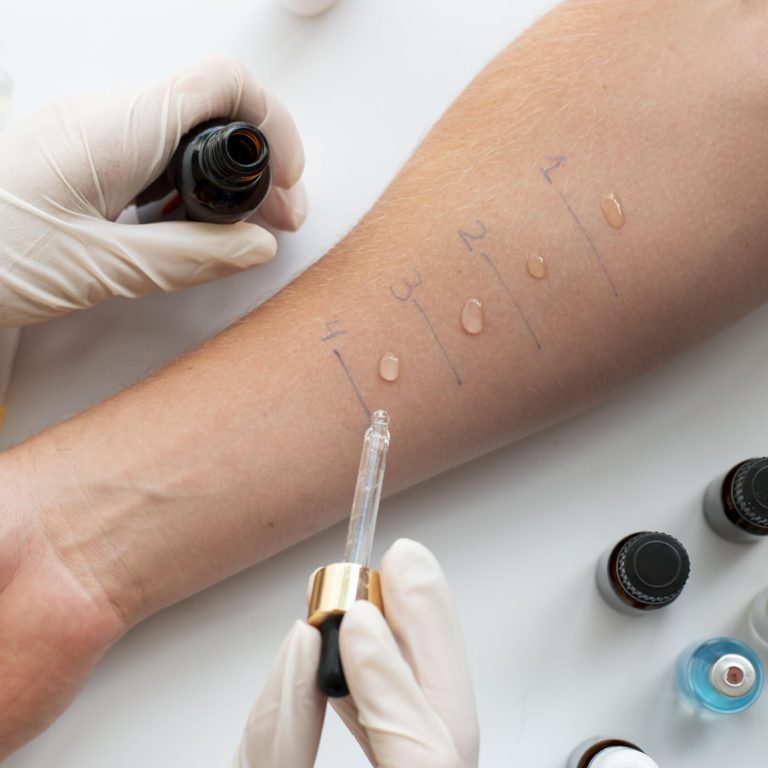 skin-allergy-reaction-test-person-s-arm