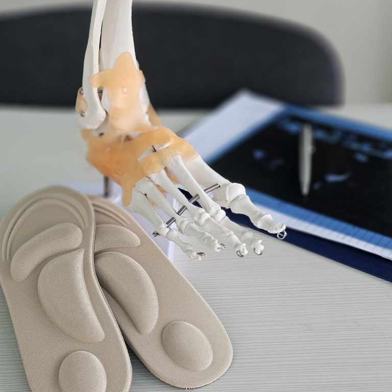 A study setup featuring model and orthotic insoles on a table
