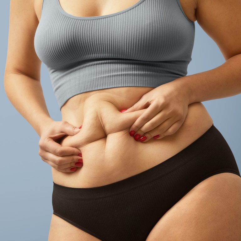 Woman body fat belly. Obese woman hands holding excessive tummy fat. Change diet lifestyle concept to shape up healthy stomach muscle. Studio anonymous shot photo of body parts.
